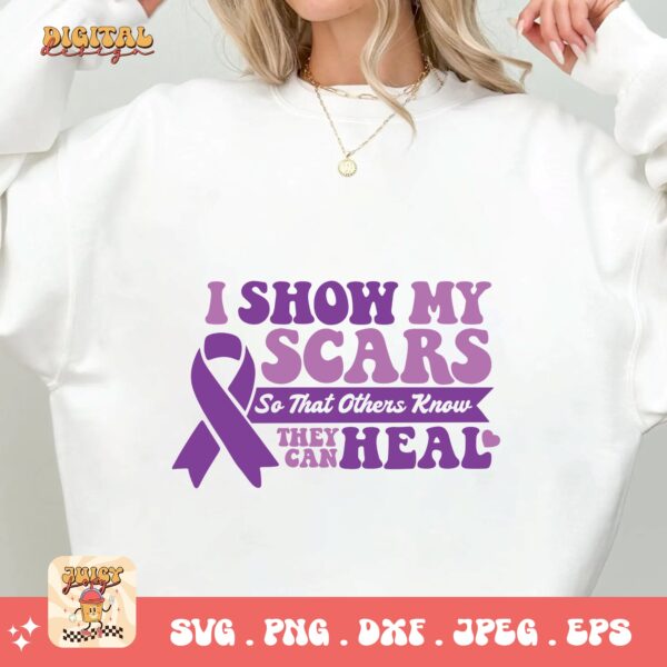 Domestic Violence Awareness Svg Png, I Show My Scars So That Others Know They Can Heal Svg, Domestic Abuse Svg Cricut File Sublimation - Image 2