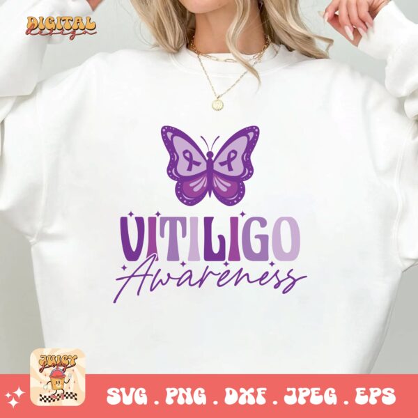 Vitiligo Awareness Svg, Vitiligo Awareness Svg Png, Purple Ribbon Vitiligo Support Svg Cricut Sublimation - Image 2
