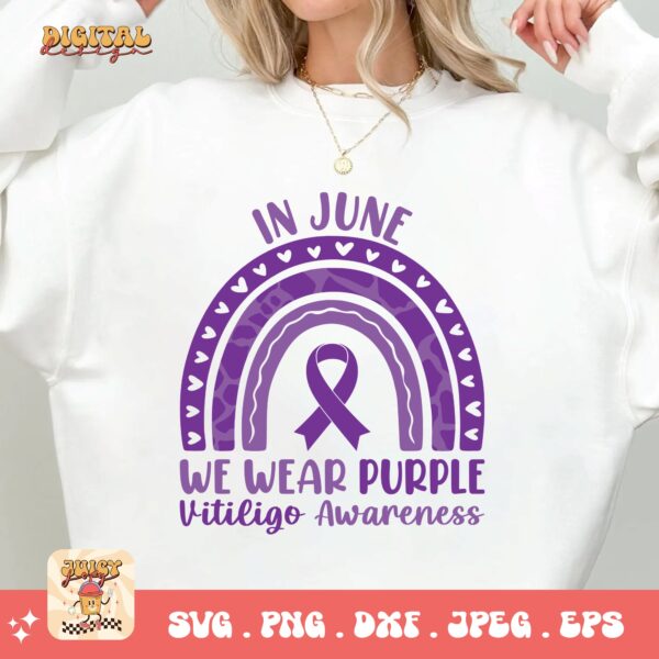 In June We Wear Purple Svg, Vitiligo Awareness Svg Png, Purple Ribbon Vitiligo Support Svg Cricut Sublimation - Image 2