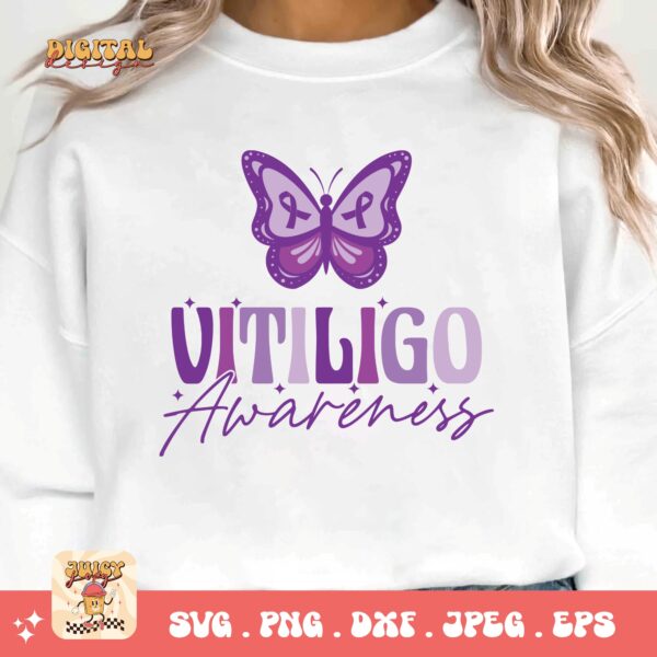 Vitiligo Awareness Svg, Vitiligo Awareness Svg Png, Purple Ribbon Vitiligo Support Svg Cricut Sublimation - Image 3